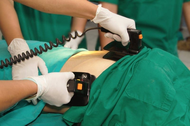 Defibrillator Paddles on Patient