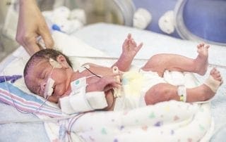understanding nicu and how to care for fragile neonatal patients
